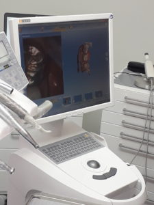 Scanner intraorale con creazione e visualizzazione modello 3D